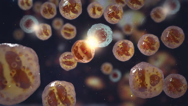 Vorschaubild Eosinophile Immundysfunktion, wissenschaftliche Illustration: Eosinophile vor der Apoptose, natürliche Killerzelle, die von einem Biologikum rekrutiert wird